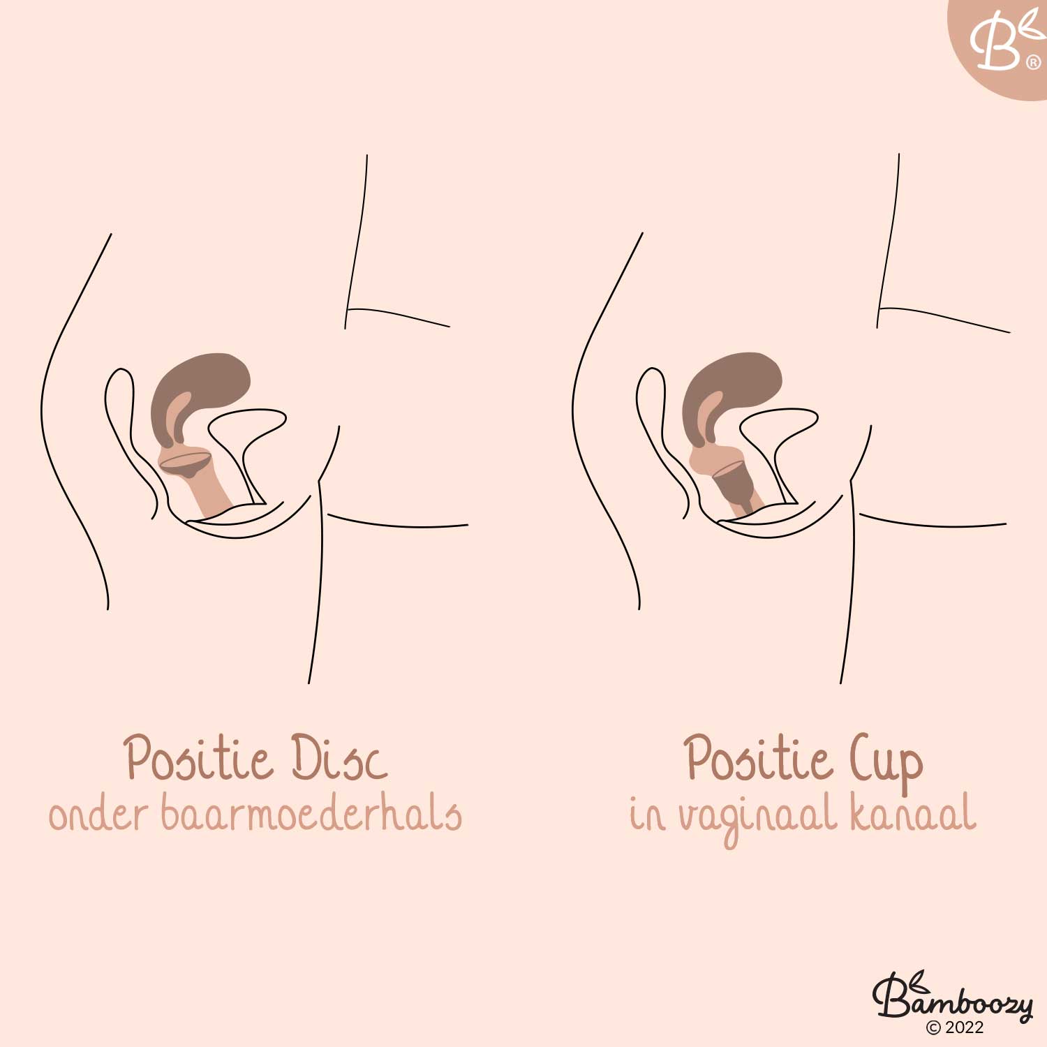 Menstruatiedisc positie