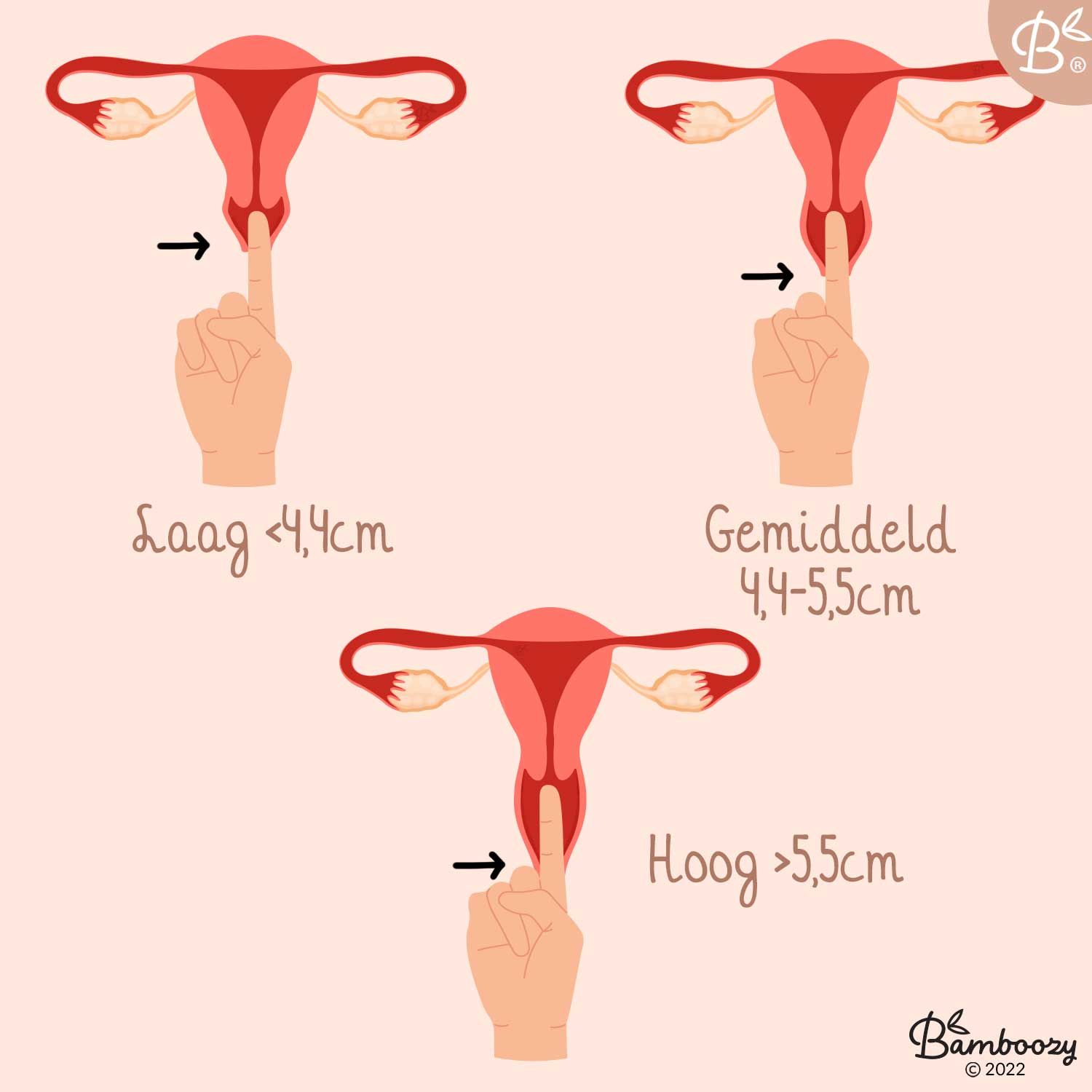 Menstruatiedisc maat